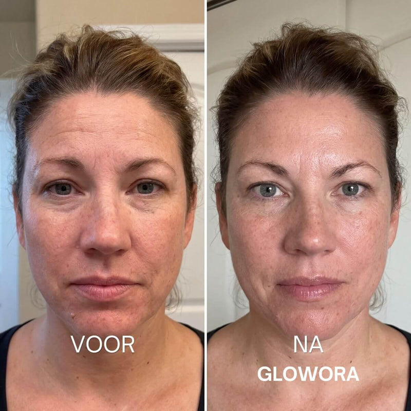 Lieke, 44