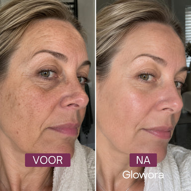 Voor-en-na zijaanzicht van een vrouw na gebruik van het Bakuchiol Peptide Serum