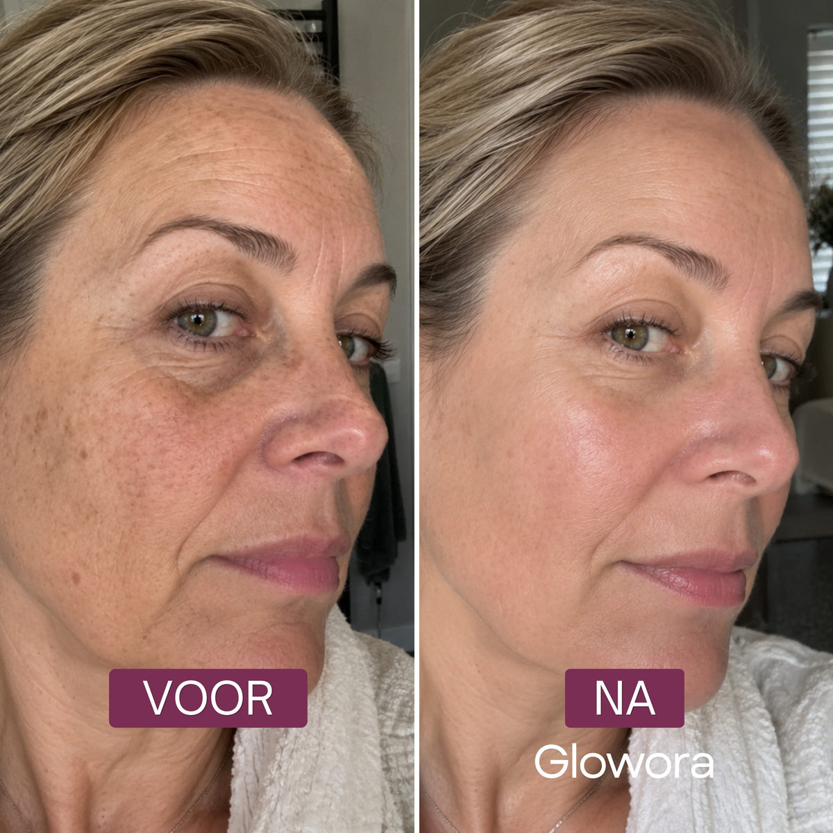 Voor-en-na zijaanzicht van een vrouw na gebruik van het Bakuchiol Peptide Serum
