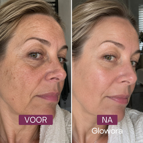 Voor-en-na zijaanzicht van een vrouw na gebruik van het Bakuchiol Peptide Serum
