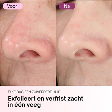 Zero Pore Pads