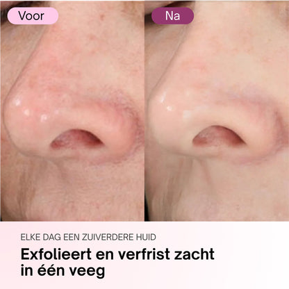 Zero Pore Pads