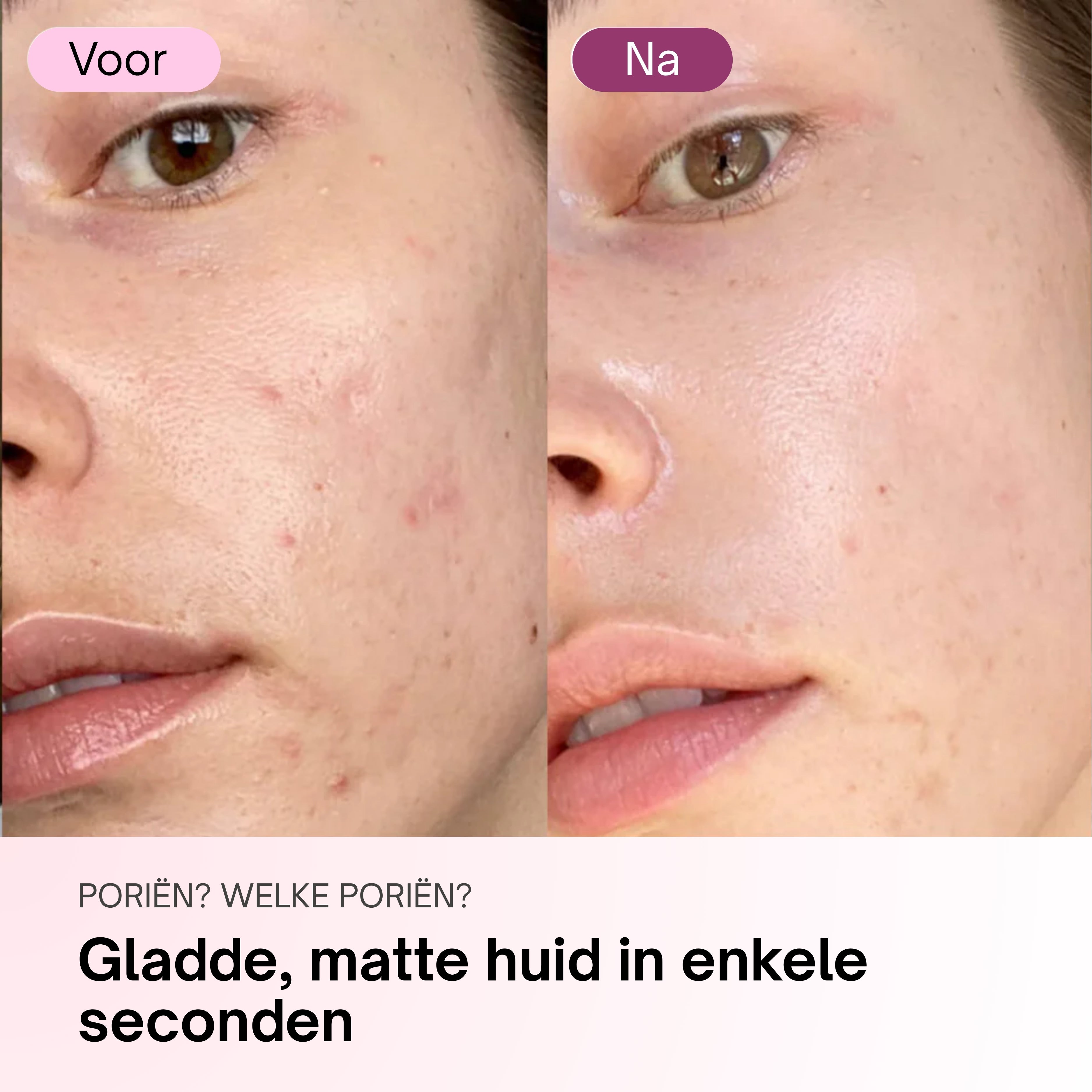 Zero Pore Pads