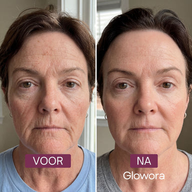 Voor-en-na vooraanzicht van het gezicht van een vrouw na gebruik van het Collageen Wrapping Masker