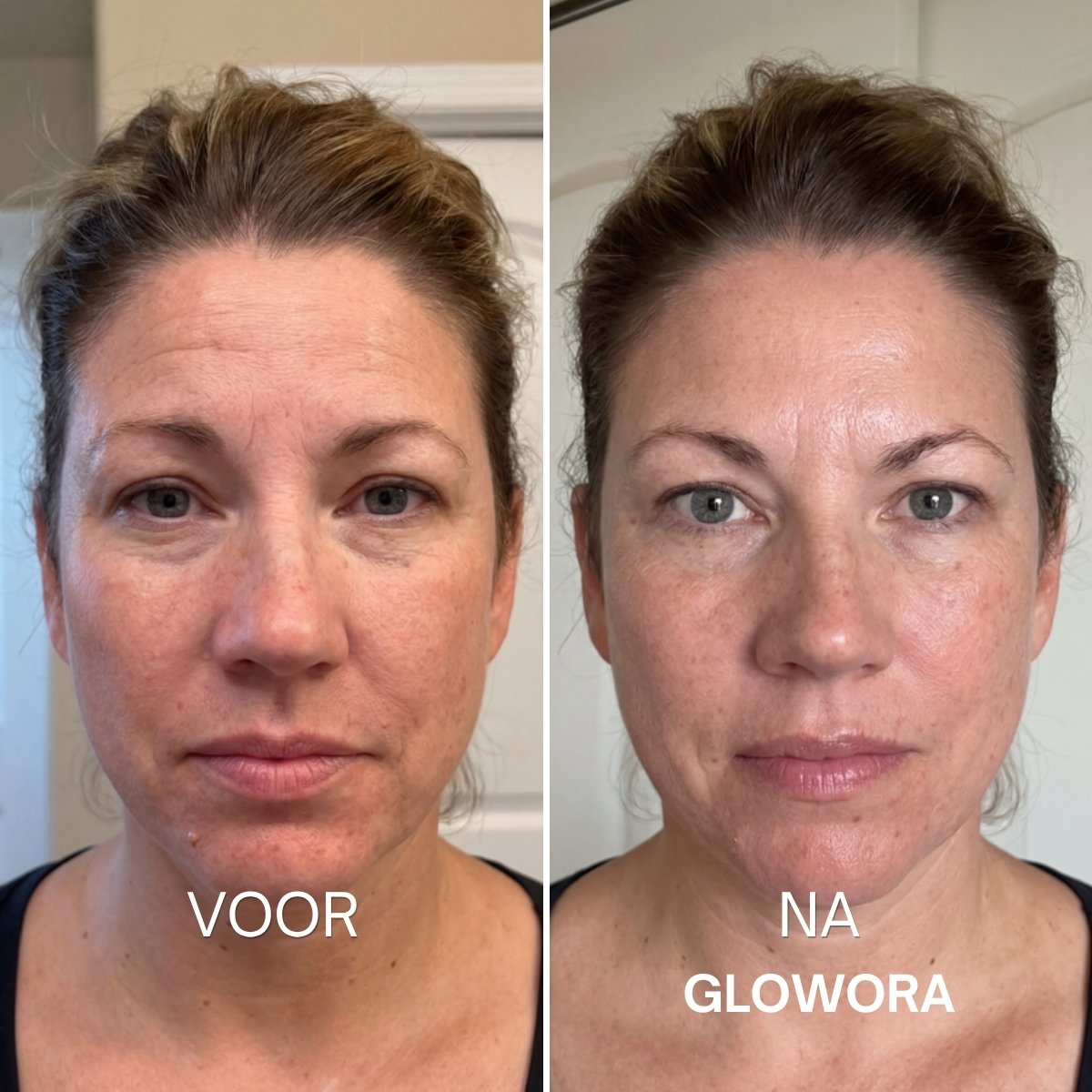 Voor en na Glowora