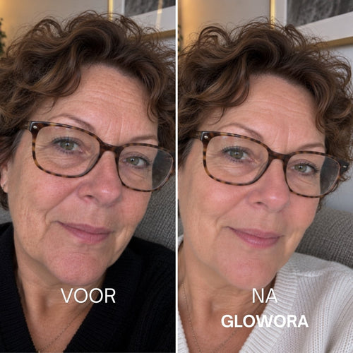 Voor en na Glowora