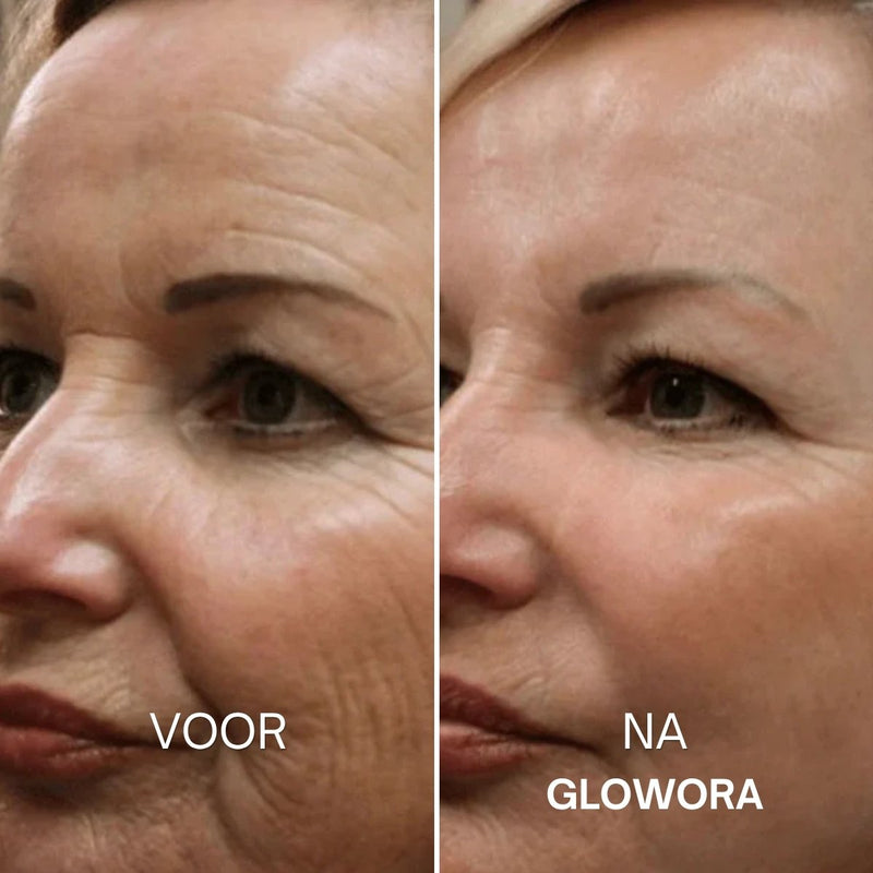 Voor en na Glowora