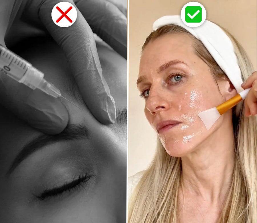 Een fractie van de prijs van Botox of dure serums